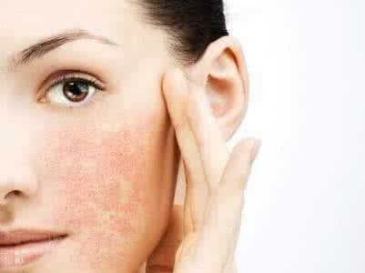 做皮肤美容警惕“慢性中毒”